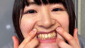 〖 街角で声をかけて口内観察させてもらう みこちゃん 〗